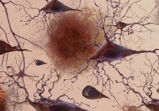 Tab af forbindelse mellem cellerne ved Alzheimers sygdom