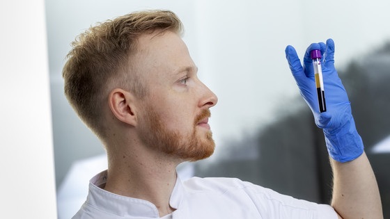 Daniel Kjærgaard har i sit projekt bl.a. undersøgt den nye biomarkør, plasma p-tau217, til identificering af Alzheimers sygdom. 