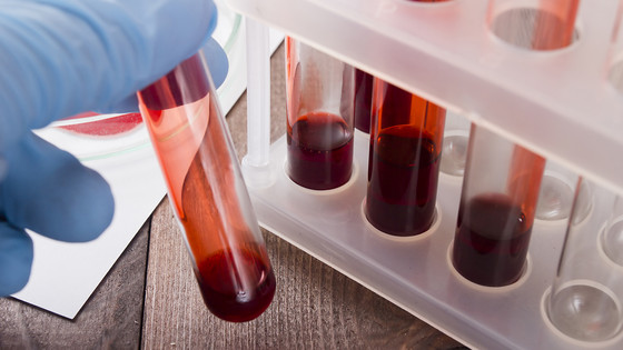 En række europæiske demensfaglige selskaber har formuleret tværfaglige anbefalinger for anvendelsen af biomarkører i diagnosticeringen af demenssygdomme. Formålet er at fremme ensartethed og høj kvalitet
