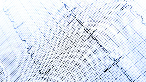 Hjertekardiogram